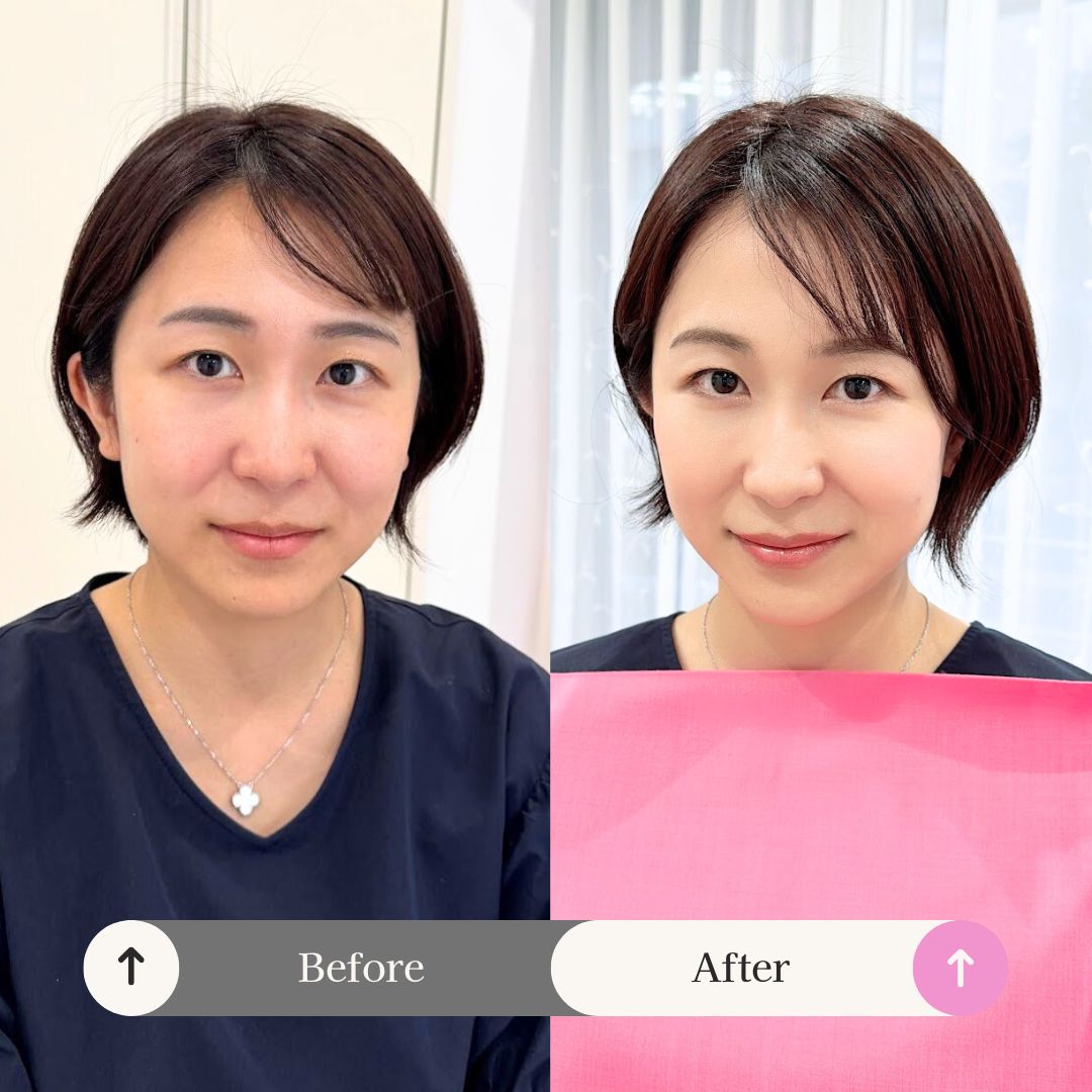 垢抜けメイクレッスンbefore 6 after