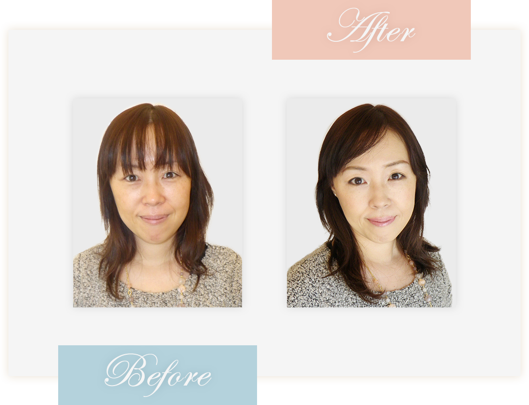 Before&After