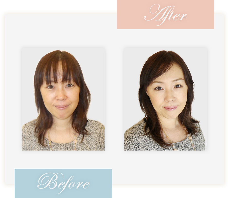 Before&After