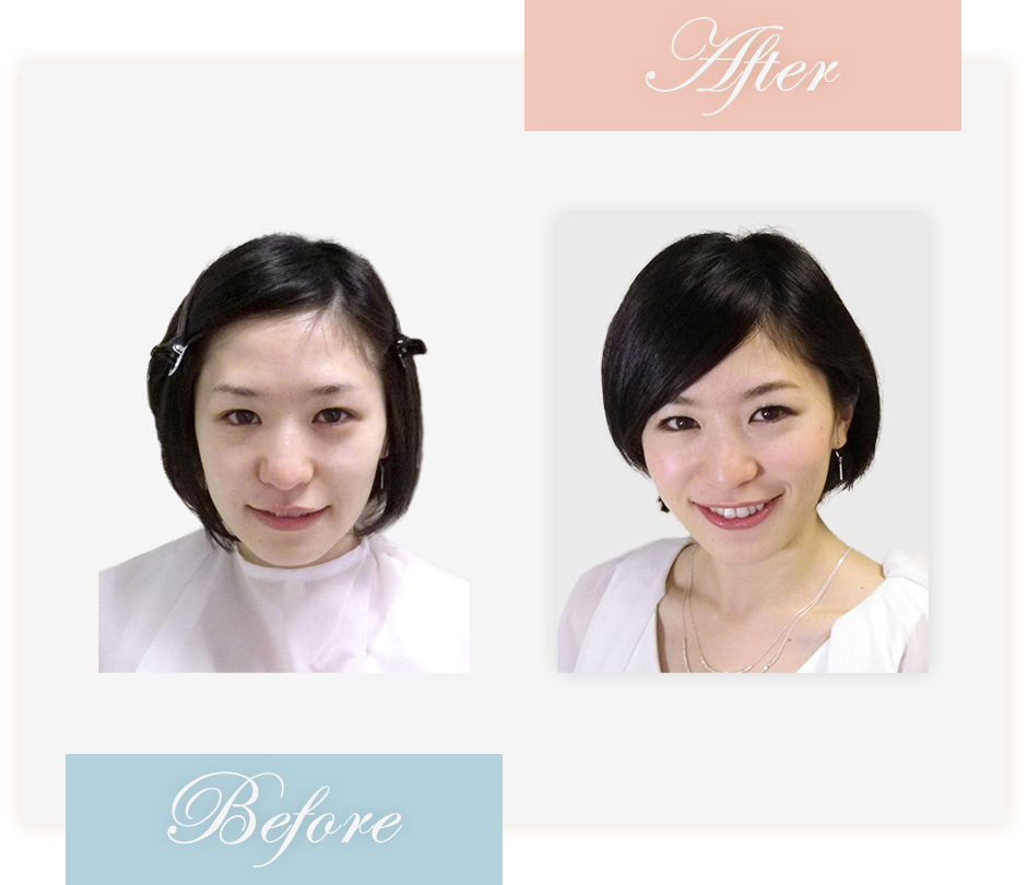 Before&After
