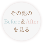その他のBefore&Afterを見る
