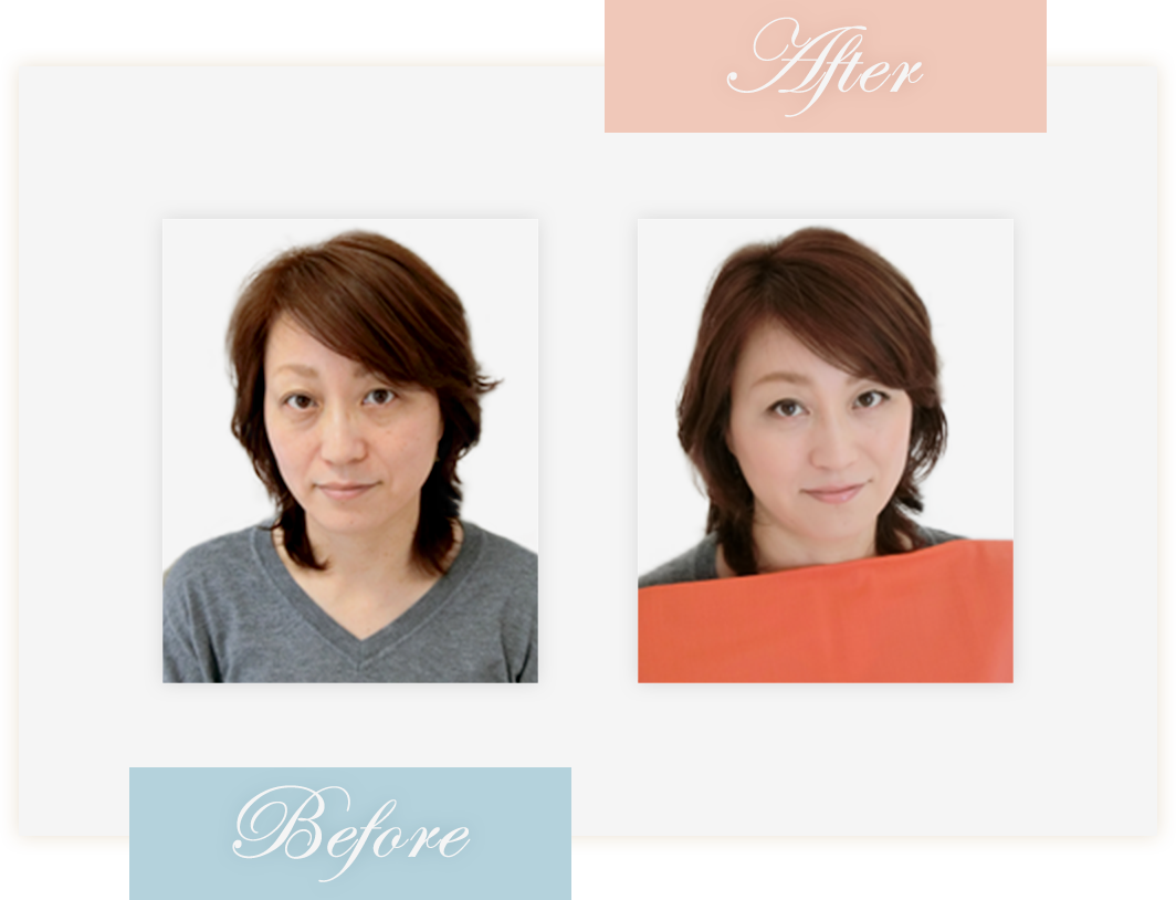 Before&After