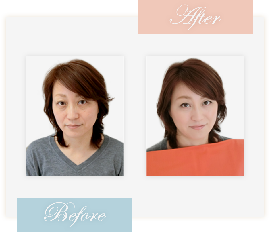 Before&After