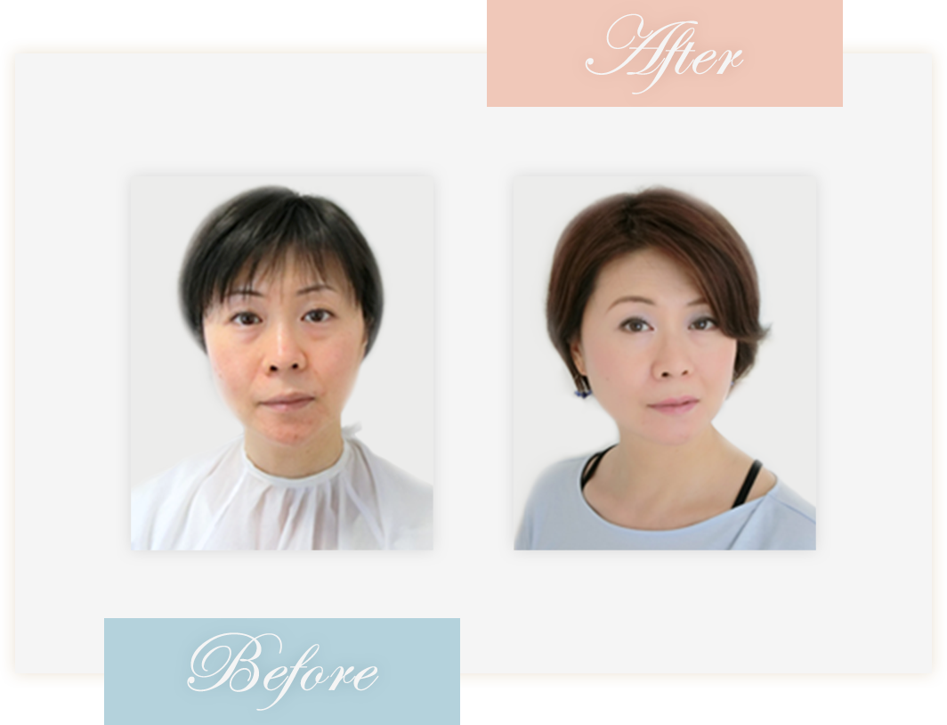 Before&After