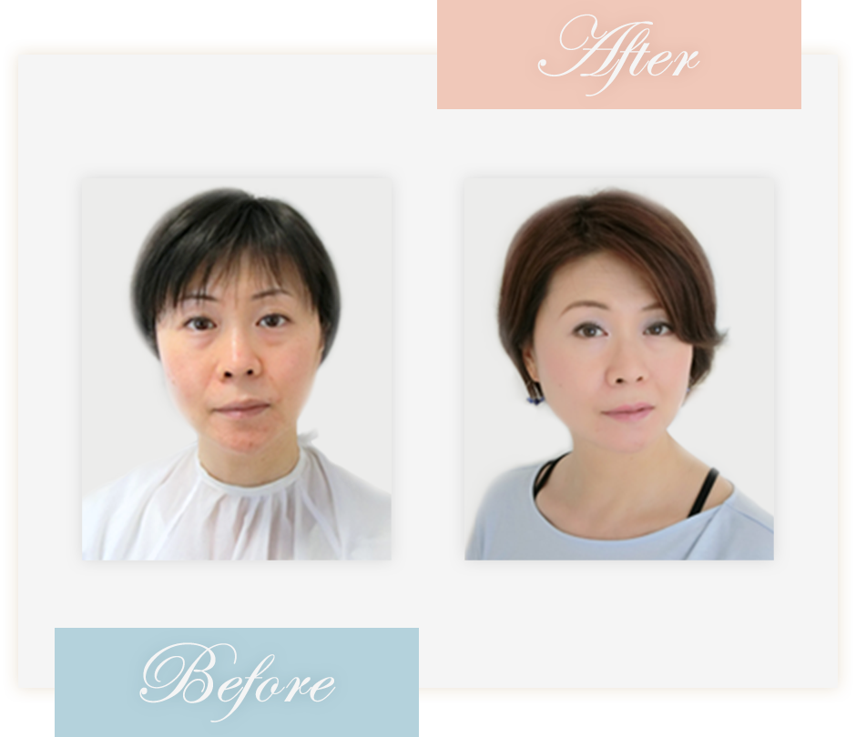 Before&After