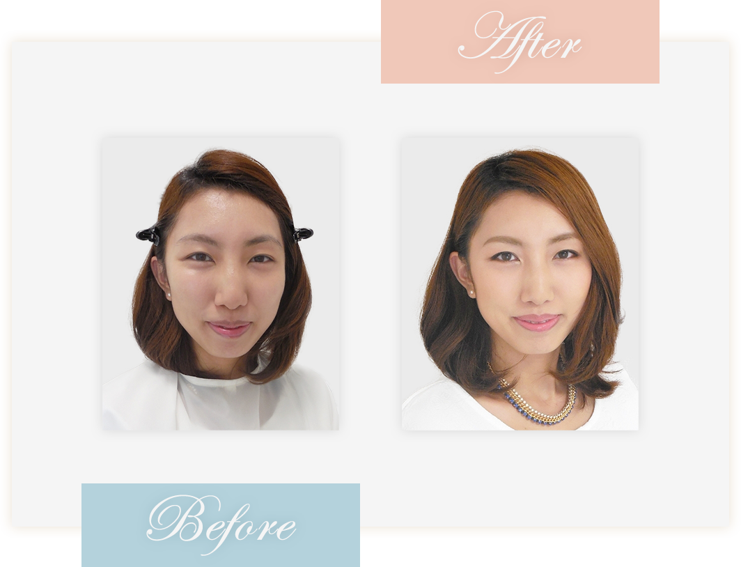 Before&After
