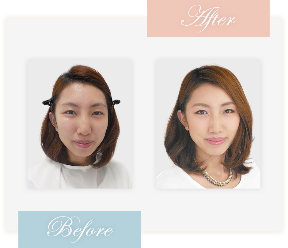 Before&After