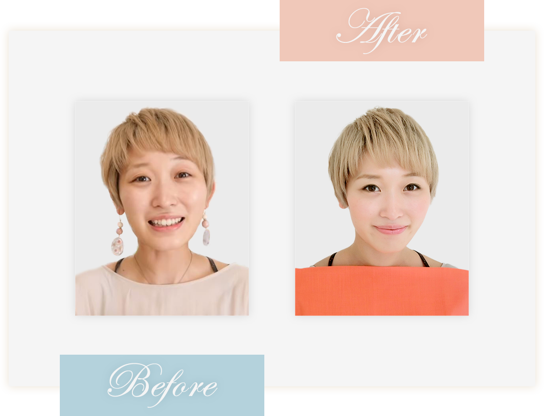 Before&After