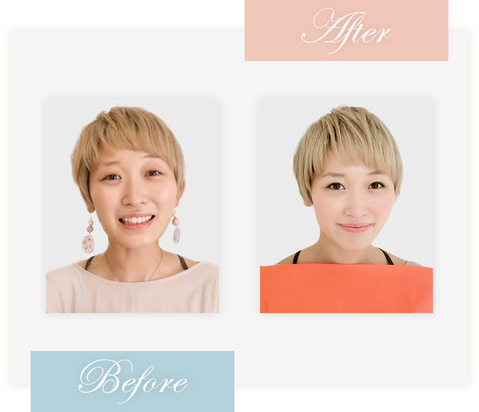 Before&After