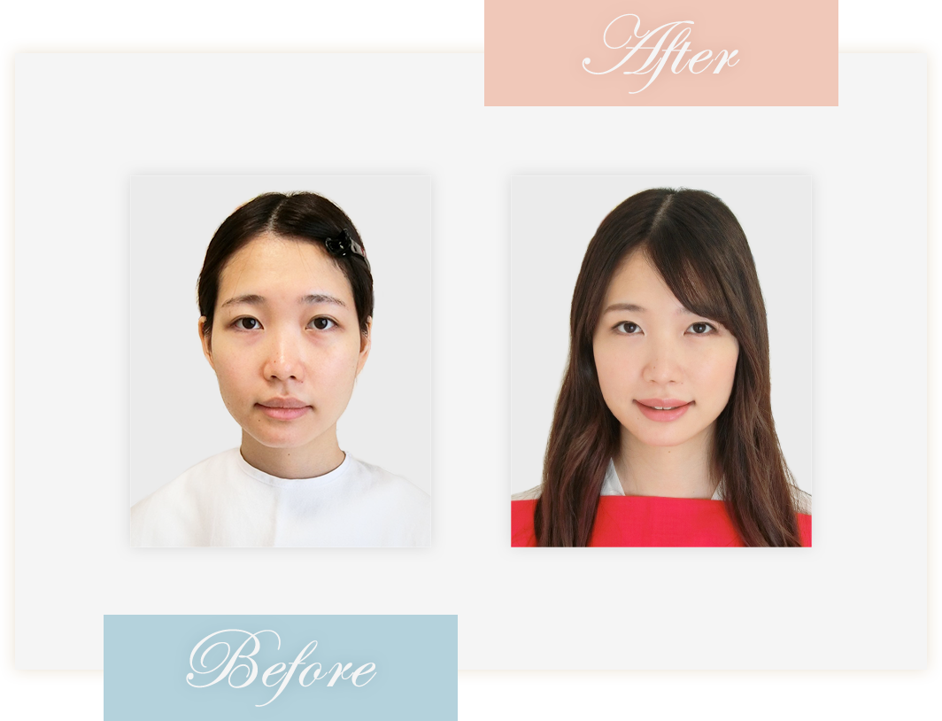 Before&After