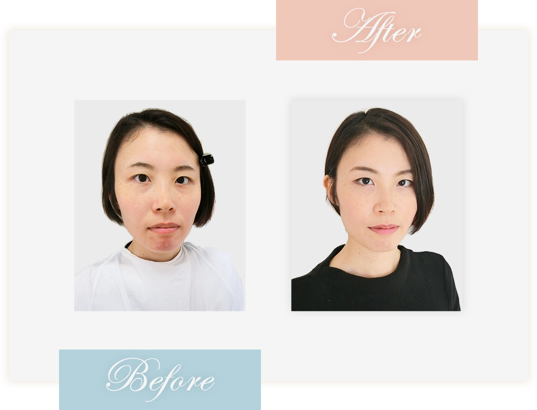 Before&After