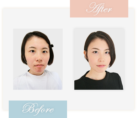 Before&After